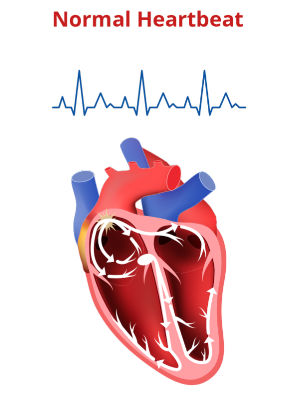 Heart graphic showing a normal heartbeat.